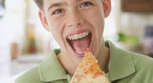 Can You Eat Pizza With Braces